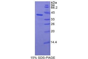 SDS-PAGE analysis of Rat C3a Protein. (C3a Protéine)