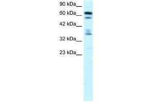 ZNF512 antibody used at 0. (ZNF512 anticorps  (Middle Region))