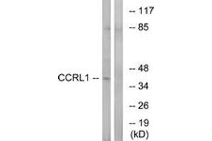 Western blot analysis of extracts from HepG2 cells, using CCRL1 Antibody. (CCRL1 anticorps  (AA 291-340))