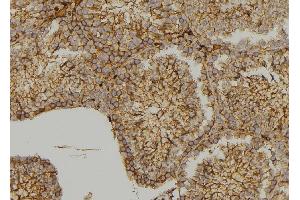 ABIN6279564 at 1/100 staining  testis tissue by IHC-P.