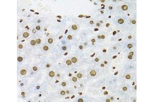 Immunohistochemistry of paraffin-embedded Mouse liver using KHDRBS1 Polyclonal Antibody at dilution of 1:100 (40x lens).