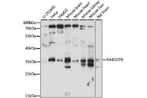 Western blot analysis of extracts of various cell lines, using RABGGTB antibody. (RABGGTB anticorps)