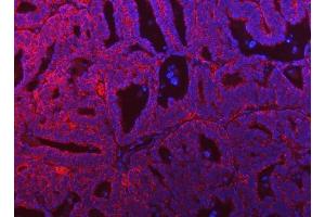 anti-seryl-tRNA Synthetase 2, Mitochondrial (SARS2) (AA 46-518) antibody