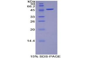 SDS-PAGE analysis of Rat MYL6B Protein. (MYL6B Protéine)