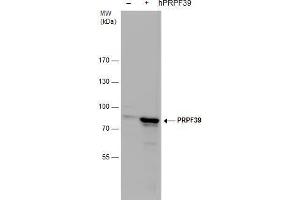 WB Image PRPF39 antibody detects PRPF39 protein by western blot analysis. (PRPF39 anticorps)