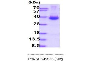 SDS-PAGE (SDS) image for Dickkopf Homolog 1 (DKK1) (AA 32-266) protein (His tag) (ABIN7529134)