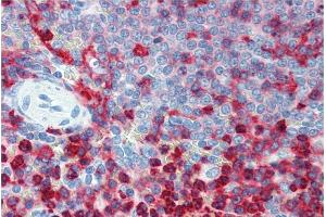Immunohistochemistry staining of human spleen (paraffin sections) using anti-CD18 (MEM-48).