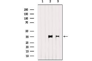 Western blot analysis of extracts from various samples, using LDHA  Antibody. (Lactate Dehydrogenase A anticorps  (C-Term))