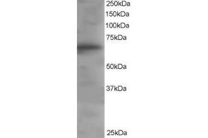 ABIN184642 staining (1µg/ml) of Human PBMC lysate (RIPA buffer, 35µg total protein per lane). (DOK3 anticorps  (C-Term))