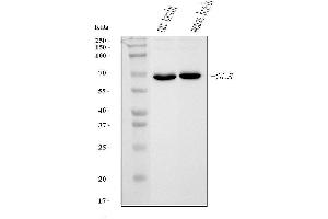 Western blot analysis of Glutaminase/GLS using anti-Glutaminase/GLS antibody (ABIN7601602). (Glutaminase anticorps  (AA 396-654))