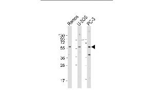 TRIM6 Antibody (N-term) (ABIN1881902 and ABIN2843419) western blot analysis in 293,A549,Ramos cell line lysates (35 μg/lane). (TRIM6 anticorps  (N-Term))