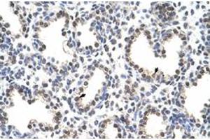 Immunohistochemical staining (Formalin-fixed paraffin-embedded sections) of human lung with FLJ12529 polyclonal antibody  at 4-8 ug/mL working concentration. (CPSF7 anticorps  (C-Term))