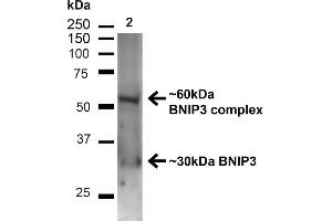 Western blot analysis of Mouse Kidney showing detection of ~30 kDa BNIP3 protein using Rabbit Anti-BNIP3 Polyclonal Antibody (ABIN2869038).