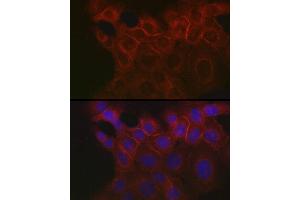 Immunofluorescence analysis of  cells using EpCAM Rabbit pAb (ABIN3021637, ABIN3021638, ABIN3021639, ABIN1513585 and ABIN6215463) at dilution of 1:100 (40x lens). (EpCAM anticorps  (AA 40-260))