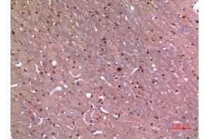 Immunohistochemistry (IHC) analysis of paraffin-embedded Rat Brain, antibody was diluted at 1:100.