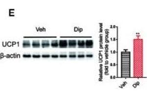 Diphyllin enhances brown/beige thermogenesis and reduces adipocyte size in DIO mice.