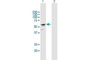 Western Blot analysis of EFHA2 expression in transfected 293T cell line by EFHA2 MaxPab polyclonal antibody. (EFHA2 anticorps  (AA 1-530))