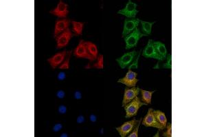 ABIN7094769 and ABIN7098820 staining HepG2 cells by IF/ICC. (PRMT3 anticorps  (Internal Region))