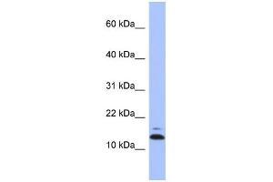 WB Suggested Anti-ASAH1 Antibody Titration: 0. (ASAH1 anticorps  (N-Term))