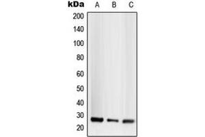 Western blot analysis of CD256 expression in HEK293T (A), SP2/0 (B), H9C2 (C) whole cell lysates.