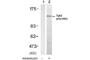Image no. 1 for anti-Tyrosine Kinase 2 (TYK2) (pTyr1054) antibody (ABIN319229) (TYK2 anticorps  (pTyr1054))