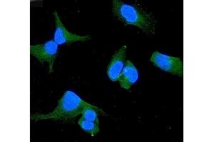 anti-WW Domain Containing Oxidoreductase (WWOX) (AA 1-245) antibody