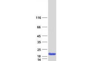 Validation with Western Blot