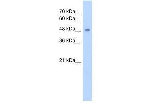 CYP2A13 antibody used at 5 ug/ml to detect target protein.