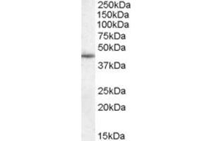 Western Blotting (WB) image for anti-ELKS/RAB6-Interacting/CAST Family Member 1 (ERC1) (C-Term) antibody (ABIN2788092) (ERC1 anticorps  (C-Term))