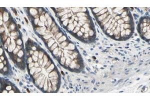 ABIN6273041 at 1/100 staining Rat colon tissue by IHC-P. (DIAPH3 anticorps  (Internal Region))