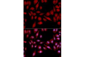 Immunofluorescence analysis of U2OS cells using PSMA2 antibody (ABIN5971338). (PSMA2 anticorps)