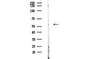 anti-Keratin 82 (KRT82) (C-Term) antibody