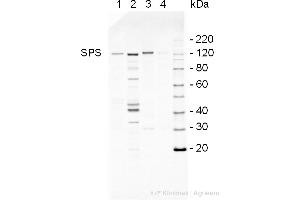 Western Blotting (WB) image for anti-SPS antibody (ABIN5706929) (SPS anticorps)