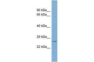 WB Suggested Anti-WBP2 Antibody Titration: 0.