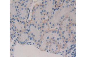 Used in DAB staining on fromalin fixed paraffin- embedded kidney tissue (Secernin 1 anticorps  (AA 2-414))