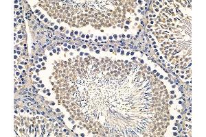 ABIN7094990 and ABIN7099046 at 1/100 staining rat testis tissue by IHC-P.