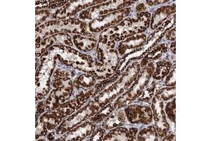 Immunohistochemical staining of human kidney with TIMM10 polyclonal antibody  shows strong cytoplasmic positivity in cells in tubules at 1:50-1:200 dilution. (TIMM10 anticorps)