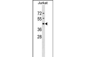 DHPS Antibody (N-term) (ABIN1539082 and ABIN2848705) western blot analysis in Jurkat cell line lysates (35 μg/lane). (DHPS anticorps  (N-Term))