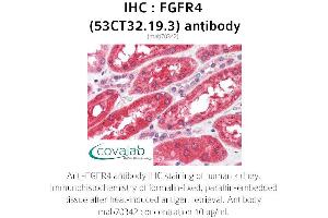 Image no. 1 for anti-Fibroblast Growth Factor Receptor 4 (FGFR4) antibody (ABIN2851987) (FGFR4 anticorps)