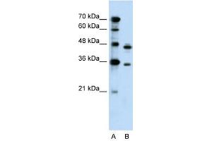 PRPS2 antibody used at 0. (PRPS2 anticorps  (Middle Region))