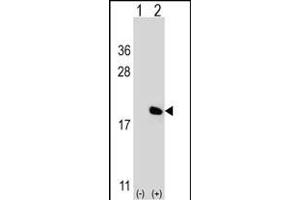 Western blot analysis of IL17A (arrow) using rabbit polyclonal IL17A Antibody (Center) (ABIN656842 and ABIN2846049). (Interleukin 17a anticorps  (AA 61-87))