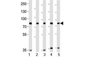 Western blot analysis of lysate from 1) A549, 2) HeLa, 3) MCF-7, 4) SH-SY5Y and 5) SW480 cell lines using Insulin Receptor Related antibody at 1:1000. (INSRR anticorps  (AA 668-702))