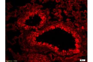 Formalin-fixed and paraffin-embedded rat lung labeled with Anti-Aggrecan Polyclonal Antibody, Unconjugated (ABIN1386175) 1:200, overnight at 4°C, The secondary antibody was Goat Anti-Rabbit IgG, Cy3 conjugated used at 1:200 dilution for 40 minutes at 37°C.