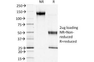 SDS-PAGE Analysis Purified S100A4 Mouse Monoclonal Antibody (S100A4/1481). (s100a4 anticorps  (AA 1-200))