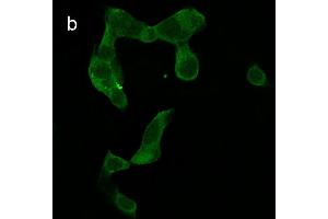Detection of cathepsin B (CB) activity in Eca-109 cells by the CB probe. (Chèvre anti-Lapin IgG Anticorps (FITC))