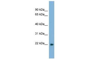 WB Suggested Anti-LBX2 Antibody Titration:  0. (LBX2 anticorps  (Middle Region))