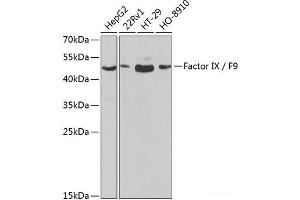 Western blot analysis of extracts of various cell lines using Factor IX / F9 Polyclonal Antibody at dilution of 1:1000. (Coagulation Factor IX anticorps)