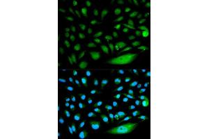 Immunofluorescence (IF) image for anti-SMAD, Mothers Against DPP Homolog 1 (SMAD1) (AA 20-240) antibody (ABIN3021439) (SMAD1 anticorps  (AA 20-240))