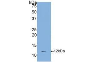 Western blot analysis of recombinant Human IL1R1. (IL1R1 anticorps  (AA 21-109))