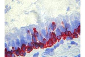 Immunohistochemistry (IHC) image for anti-Basal Membrane antibody (ABIN781795) (Basal Membrane anticorps)